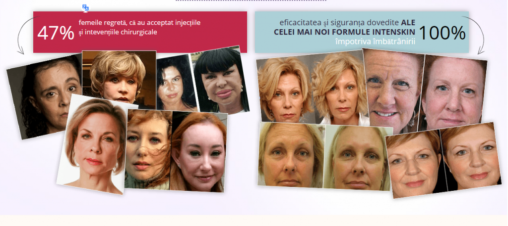 convenția anuală sdaho pentru anti-îmbătrânire botox in buze